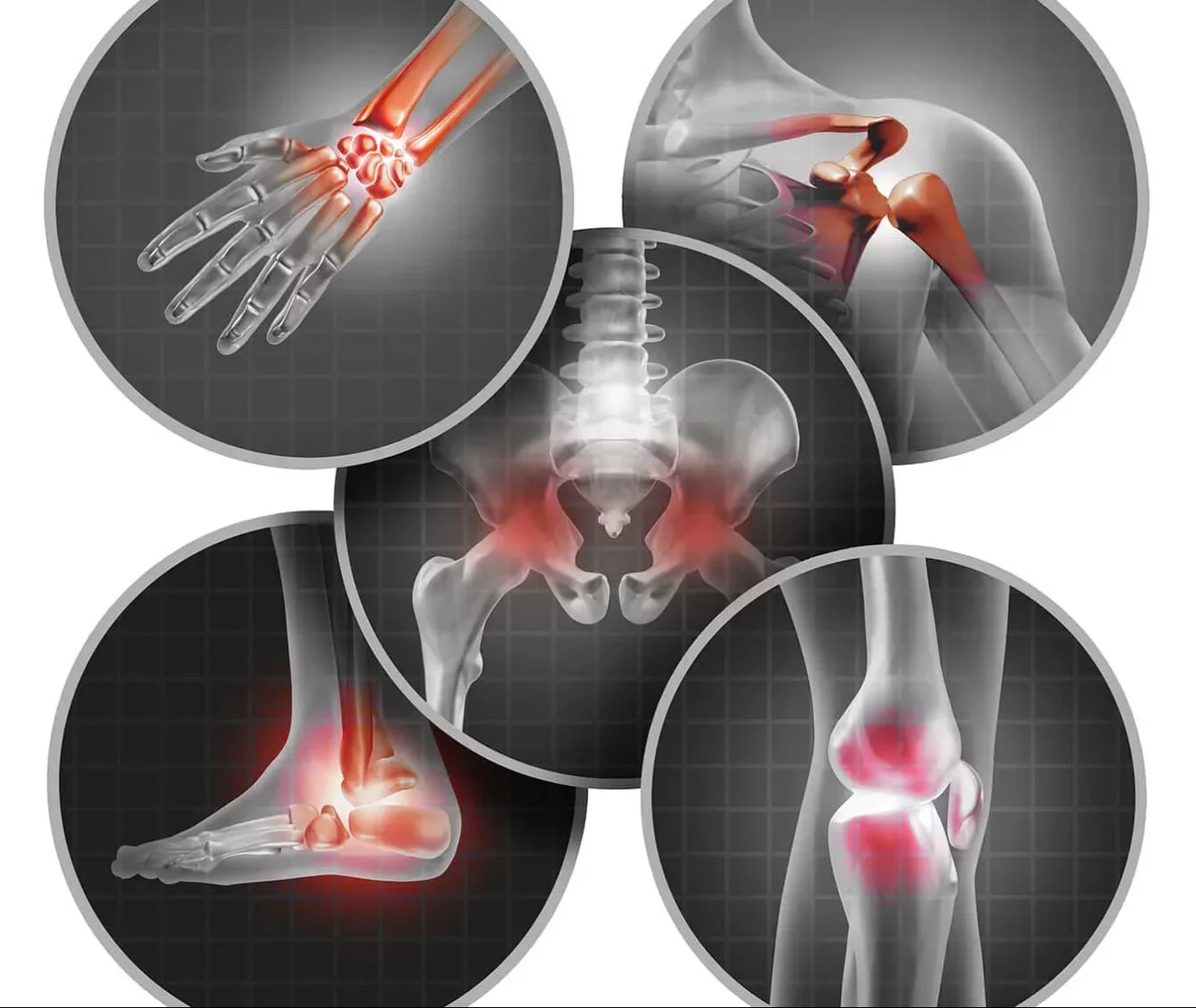 Terápiás gyakorlatok a kézízületek fájdalmára - A csontok és ízületek fájdalmainak kezelése