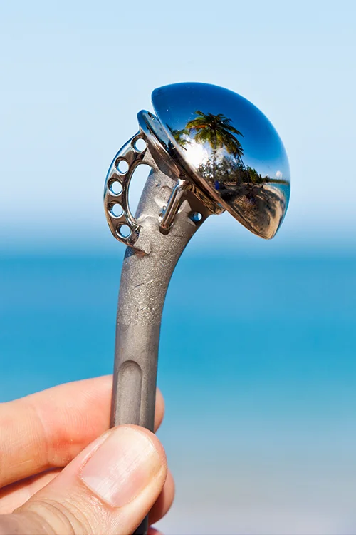 Vállprotézis kinézete Vállprotézis kinézete