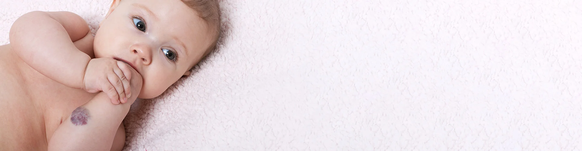 Csecsemő csípőficam Csecsemő csípőficam