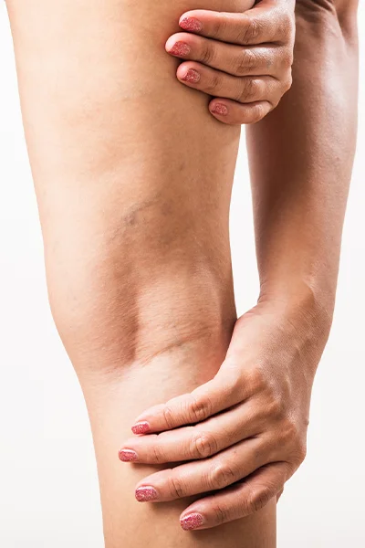 Érsebész szakorvosok által vizsgált tünetek