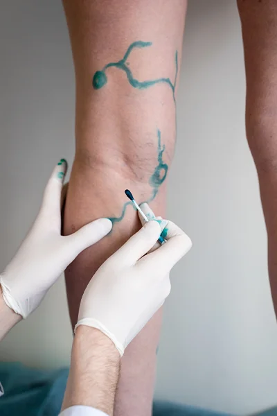 Érsebész szakorvosok által végzett vizsgálatok