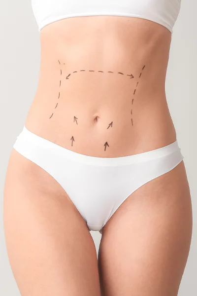 Plasztikai műtétek utáni komplex rehabilitáció