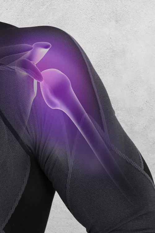 Vállfájdalom megszüntetése a vállon végzett artroszkópiás műtéttel