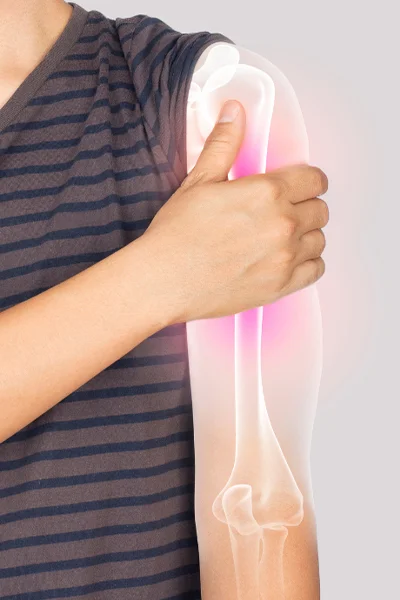 Vállízület gyulladása