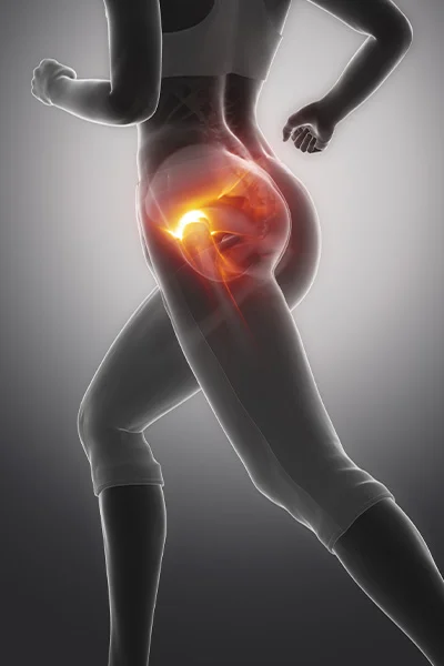 Csípőfájdalom futás közben