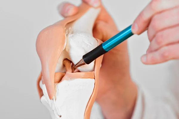 Meniscus sérülés