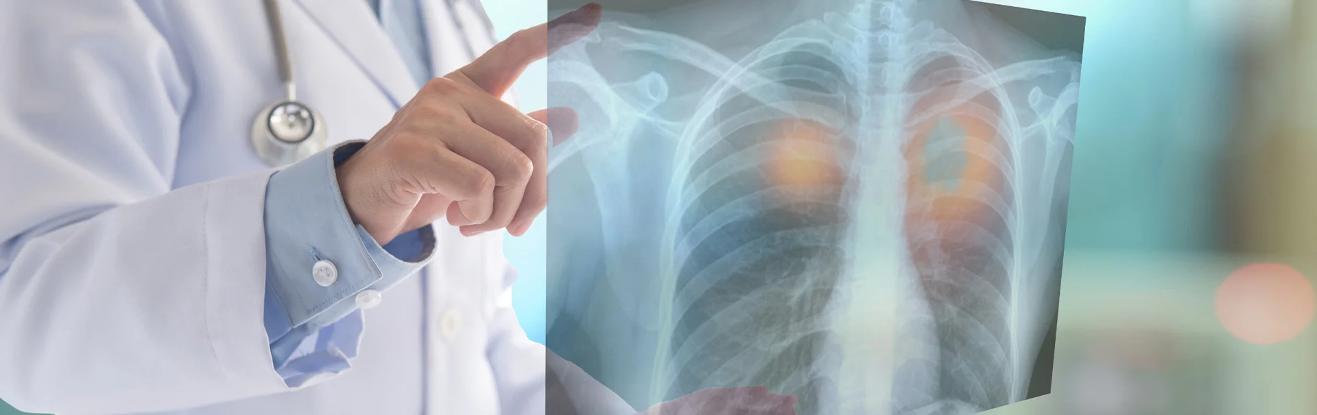 Ortopédiai ügyelet - röntgen