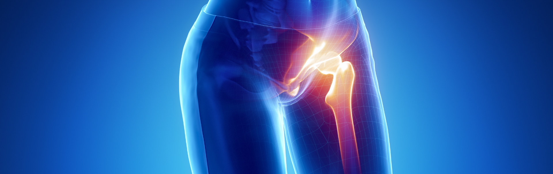 Csípőműtét tapasztalat