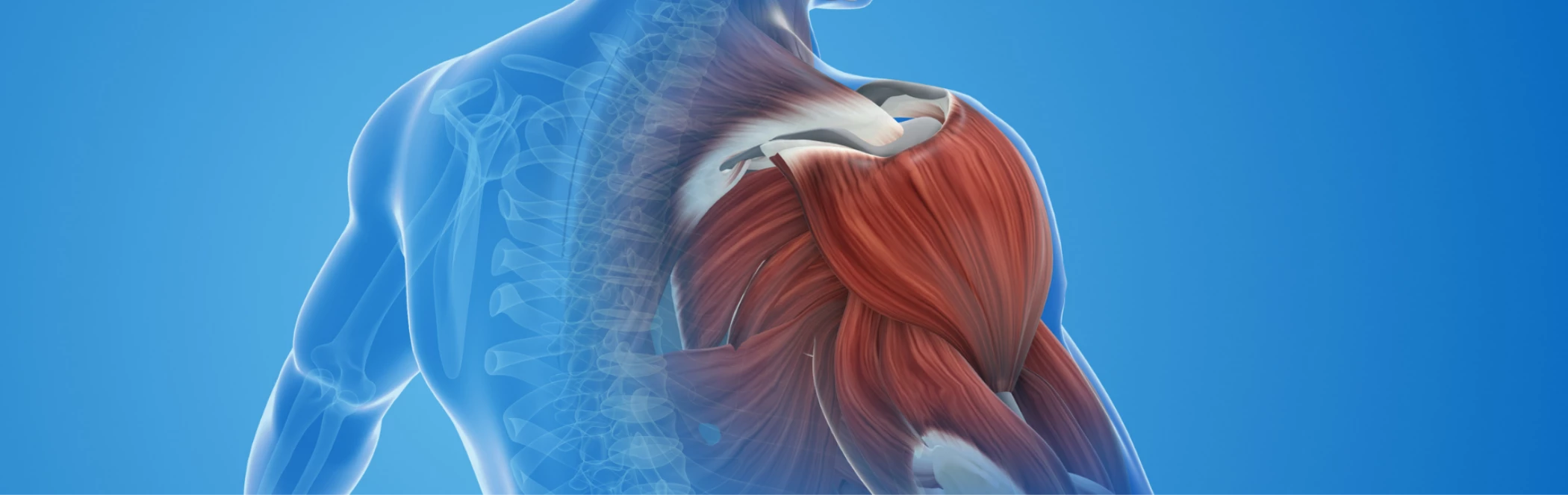 Rotátorköpeny-szakadás