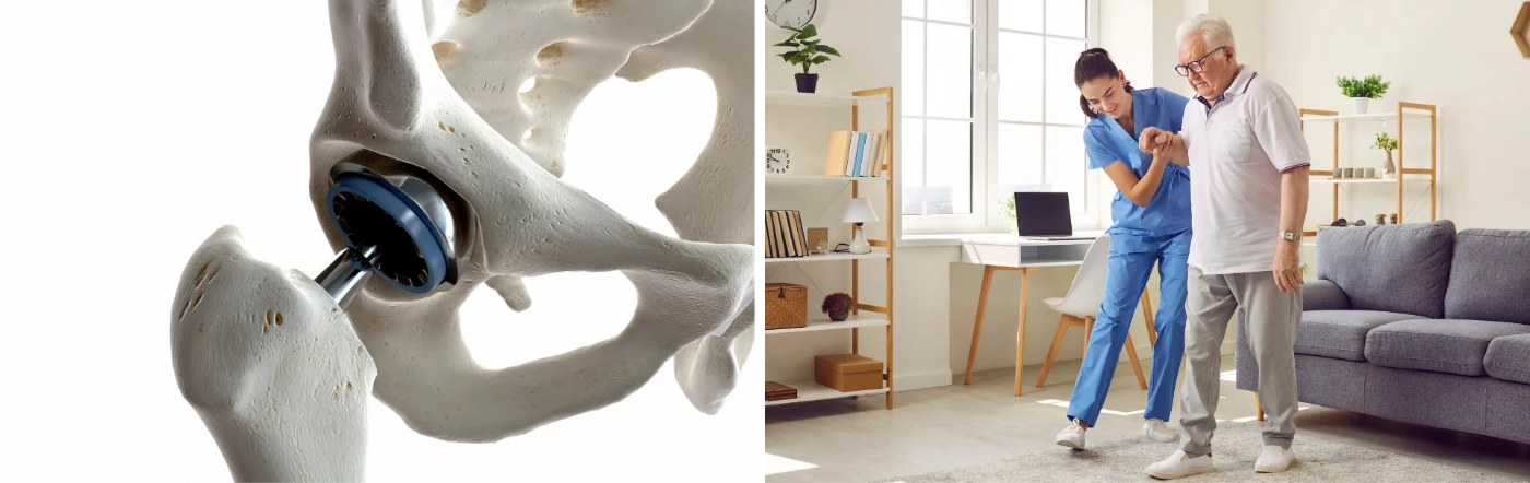 Gyógyulástörténet - csípőprotézis Gyógyulástörténet - csípőprotézis