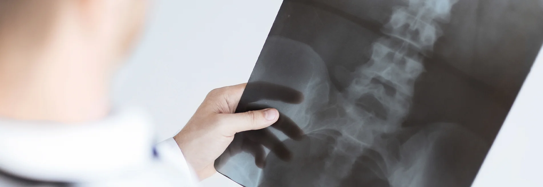 Röntgen felvétel készítése a derékfájás, gerincpanasz gyógyításához