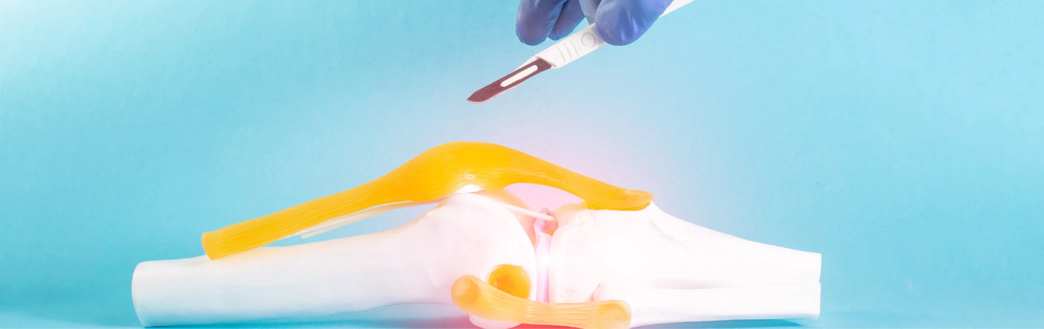 Térdműtét után újra a porondon