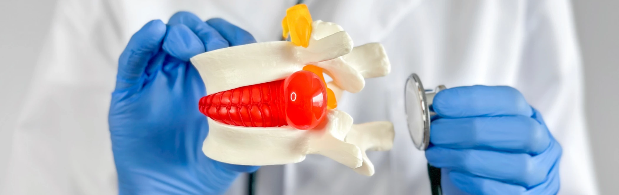 Porckorongsérv – orvosi és gyógytornász szemmel