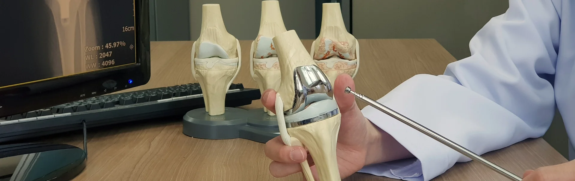 Térdprotézis gyógyulás Gyógyulástörténet Majoros Zoltán Térdprotézis műtét