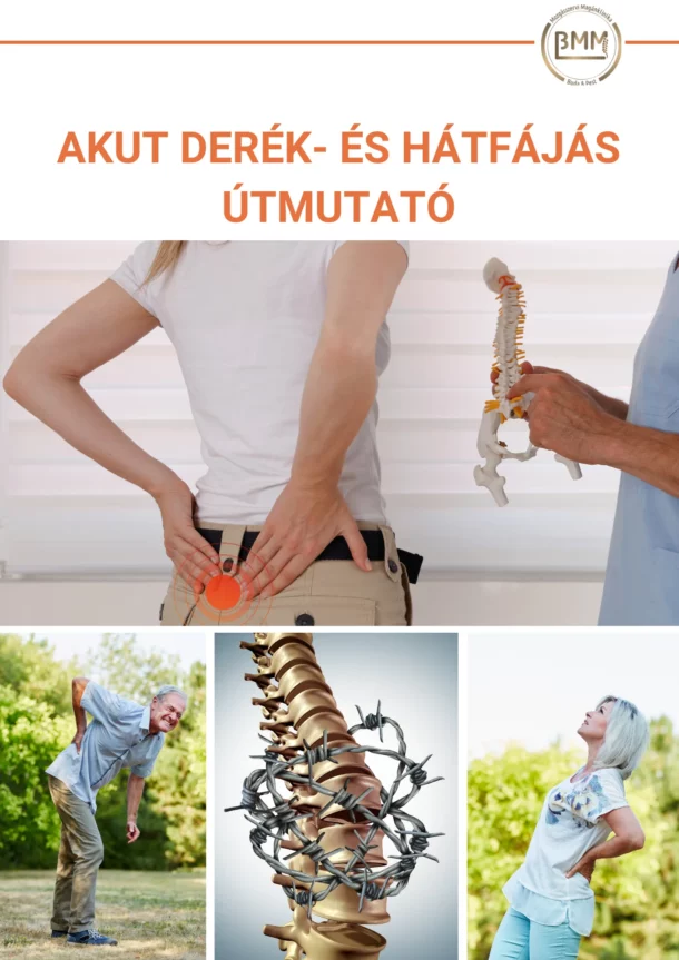 Akut derékfájás útmutató