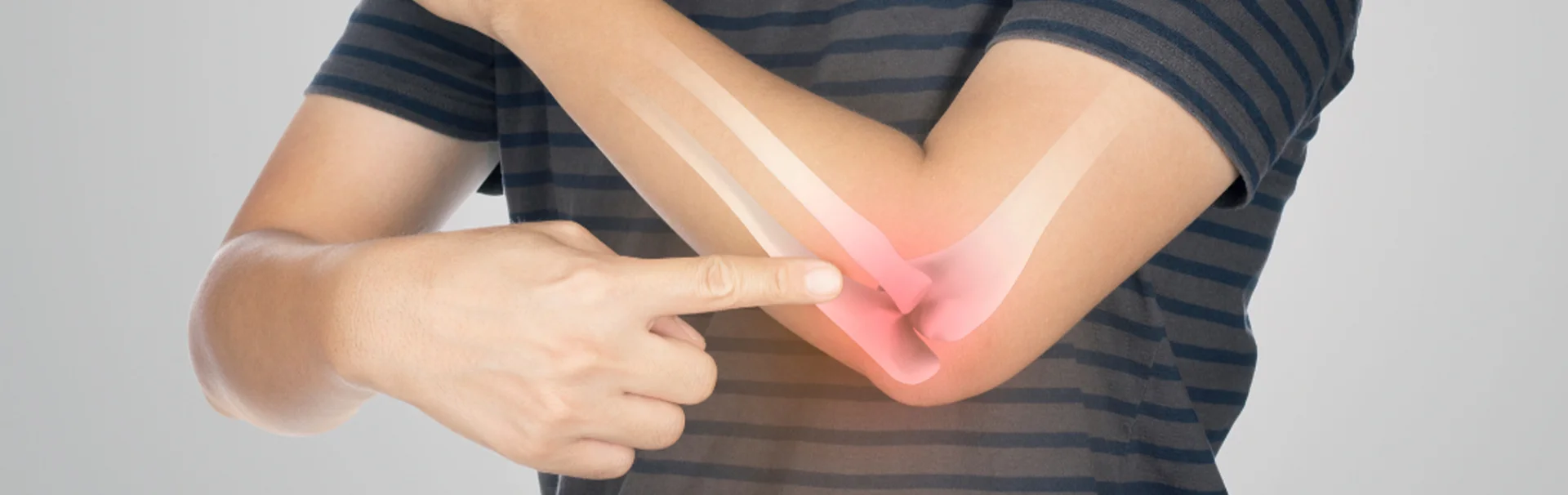 Könyökfájdalom és teniszkönyök: egy férfi a könyökére mutat, kiemelve a fájdalmas területet az ízületnél.