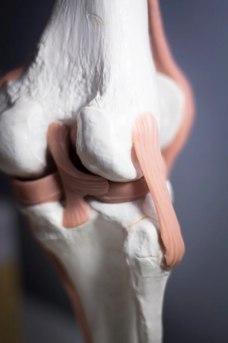 Térdízület anatómiai modellje patella ínnal, quadriceps ínnal és szalagokkal, térd ínáthelyezés szemléltetésére