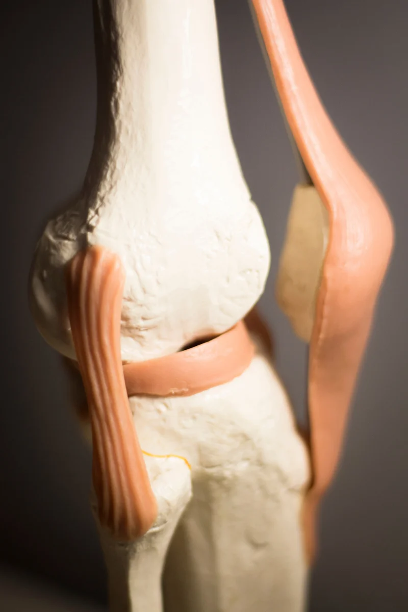 Térdízület szerkezete és a térdkalács-ficam anatómiai háttere